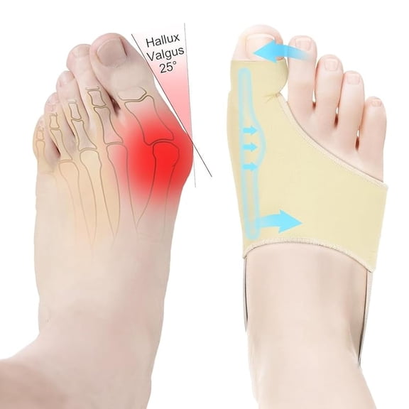 2 Bunion Correctors (Unisex) - Bunion Correctors Flexible Silicone Toe Separators Bunion Pads - Relieve Bunion. Bunion pain, day and night use of splints, comfortable and breathable-Beige