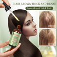 thumbnail image 3 of Rosemary Hair Care Essential Oil Hair Care essence, 3 of 5