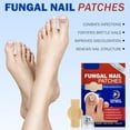 thumbnail image 6 of Easygou Fungal Nail Patches, 2026 New Fungal Nail Treatment Patches, Nail Repair Patches,Multi-Purpose Toenail Repair Treatment Pads,Toenail Patches, Antifungal Nail Treatment, 6 of 8