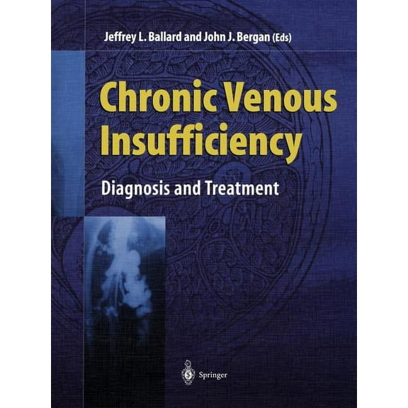 Chronic Venous Insufficiency: Diagnosis and Treatment, (Paperback)