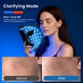 thumbnail image 5 of Morfone Red Light Therapy Mask for Face, 4 Modes LED Face Mask, 850NM Infrared & Red Light Mask, 400 LEDs, Eye Protection & Timing Function at Home, Travel, 5 of 10