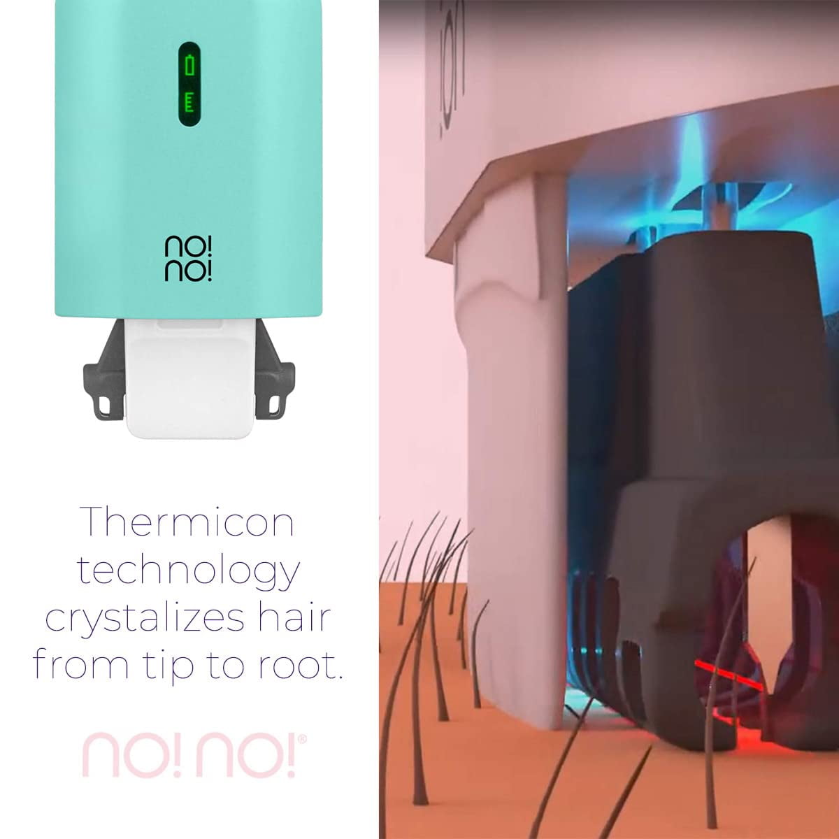 no!no! Hair Removal Device for Men and Women - Mint - Walmart.com