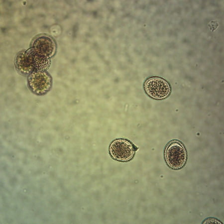 Ascaris Lumbricoides Eggs Slide  W.M. price history on PriceWatchPro