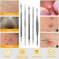 thumbnail image 6 of 5pcs Blackhead Acne Comedone Pimple Blemish Extractor Remover Stainless Tool Kit, 6 of 10