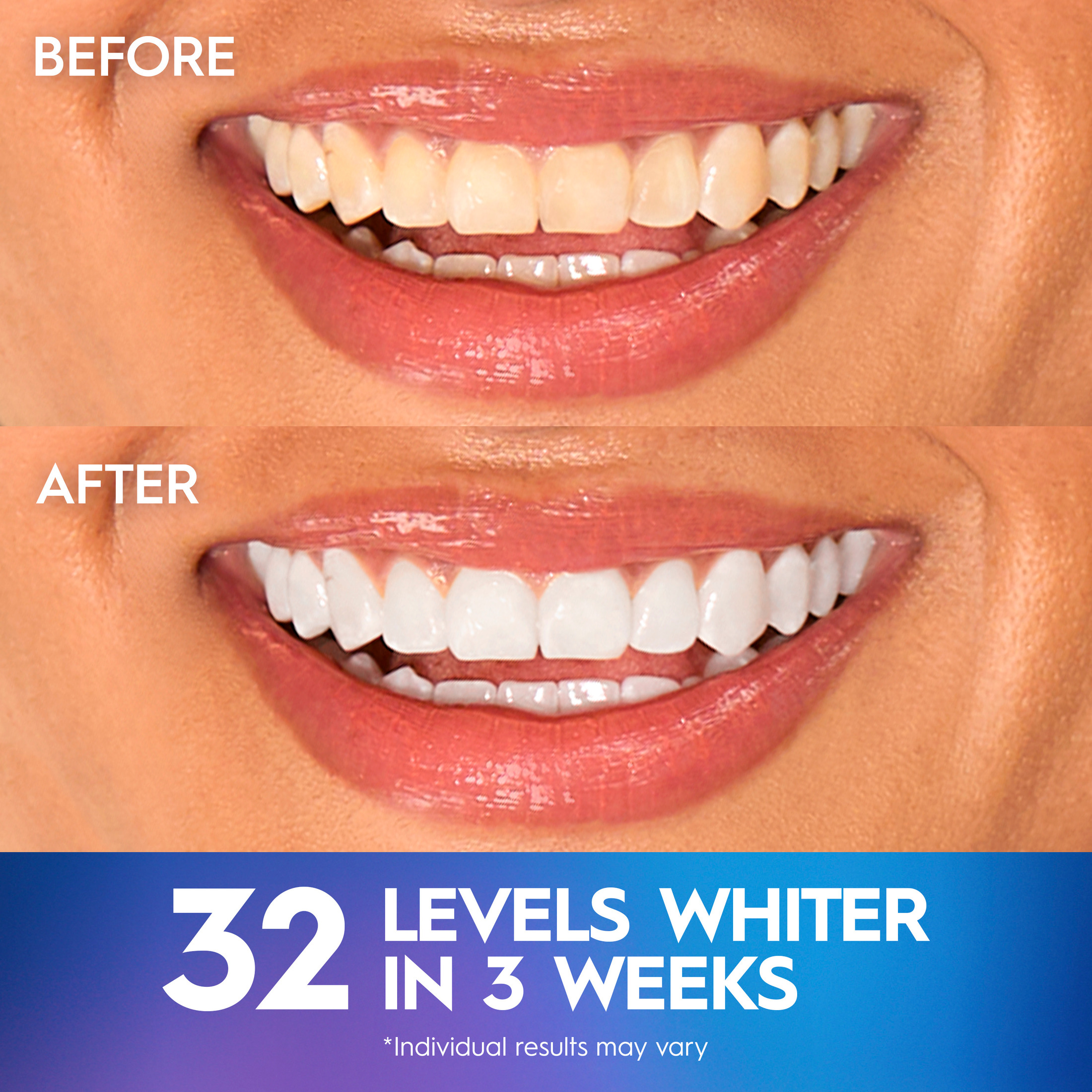 Crest 3DWhitestrips Professional White with LED Light, 19 Treatments photo 4