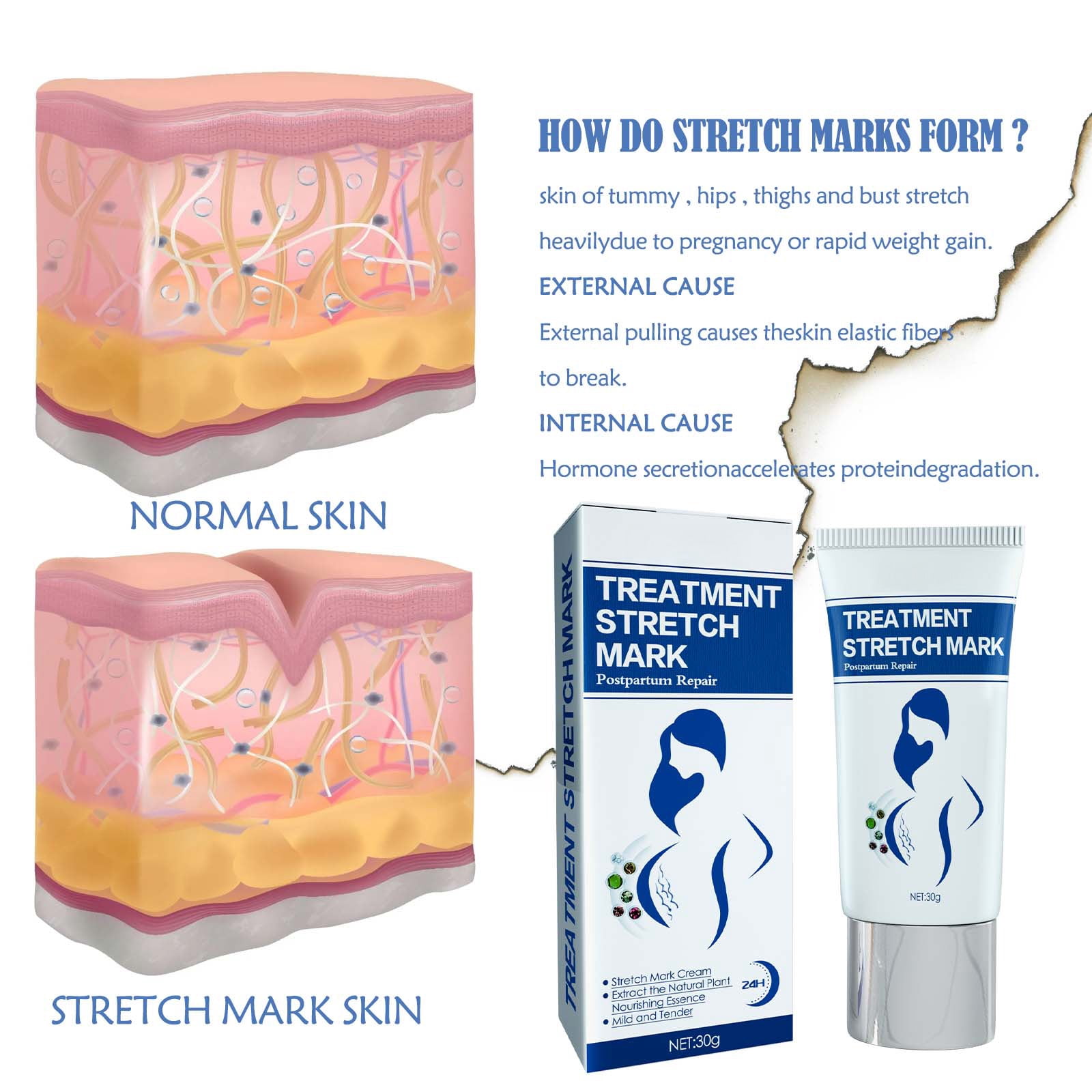 Alvantor Stretch Mark Cream for Pregnancy with Postpartum Skin Firming & Scar Fading, 1.05 oz