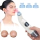 thumbnail image 5 of Limpiador de poros, herramienta extractora de puntos negros con aspiradora, resultados impresionantes, 5 of 14