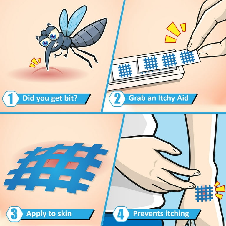 Itchy mosquito sale bites