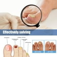 thumbnail image 2 of Aixig 60Pcs Nail Repair Stickers Breathable Nail Repair Patches Sticky Foot Care Tools, 2 of 9