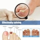 thumbnail image 5 of 60 Uds Pegatinas para Reparación Uñas Parches Transpirables Herramientas Pegajosas El Cuidado Los Pies, 5 of 9