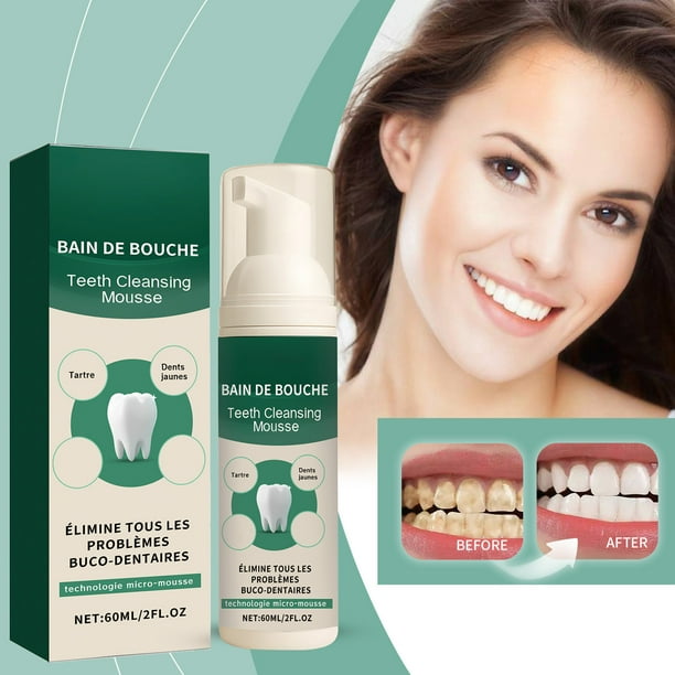 Salud y Belleza, Cuidado Personal, Pasta de Dientes, Pasta de Dientes, Mousses de Espuma Limpiadores Dentales Push-type Fresh Breath Oral Cleaning Care 60ml, Mousses de Espuma Limpiadores Dentales