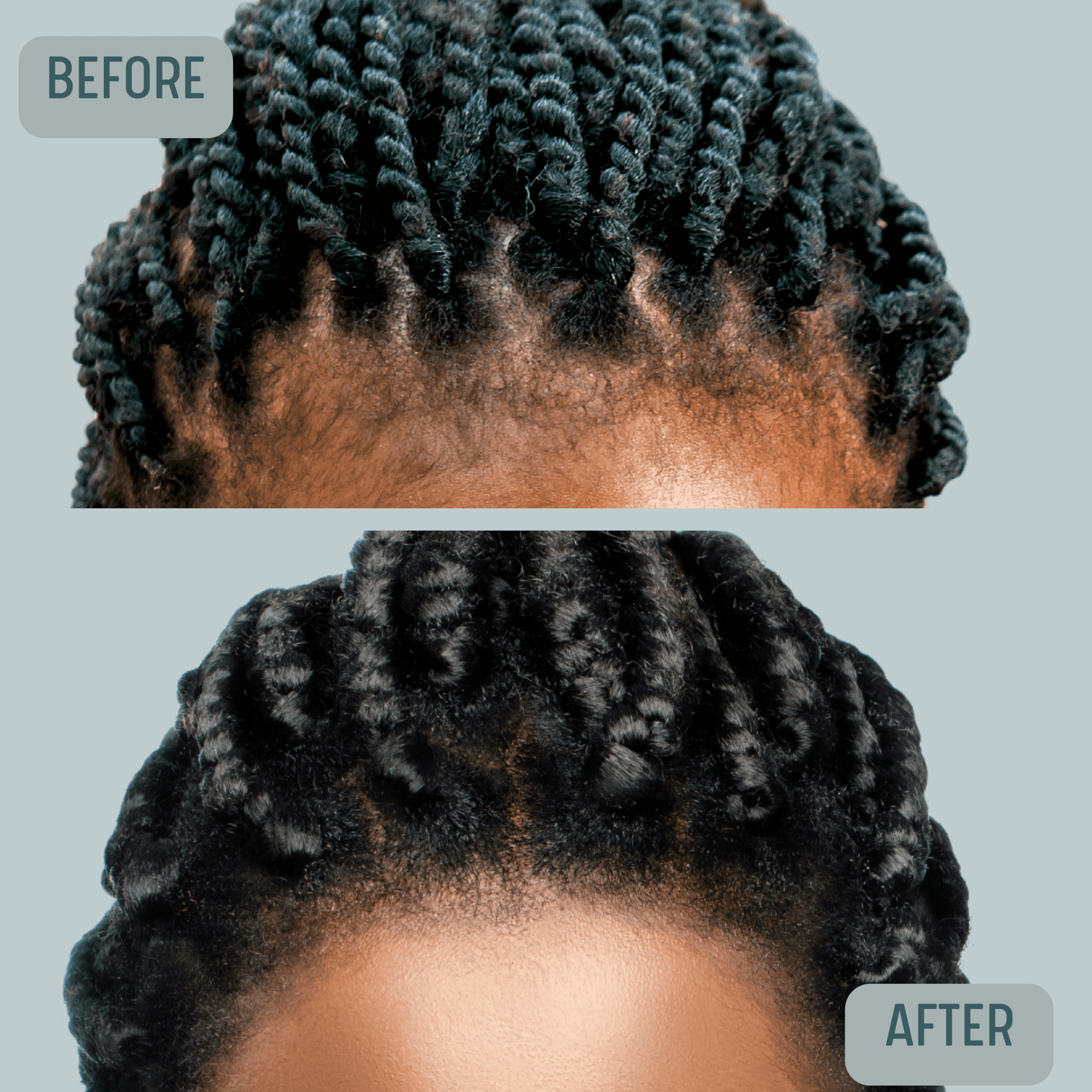 Just Nutritive Loss & Thin Black Hair Treatment, for Hair Regrowth, Argan & Rosemary Oil, 4oz