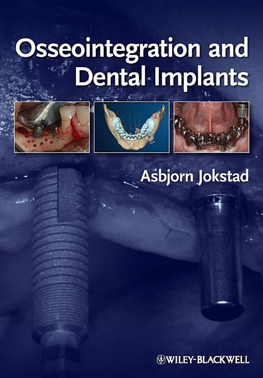 Implant Dentistry : Theory and Practice - Walmart.com