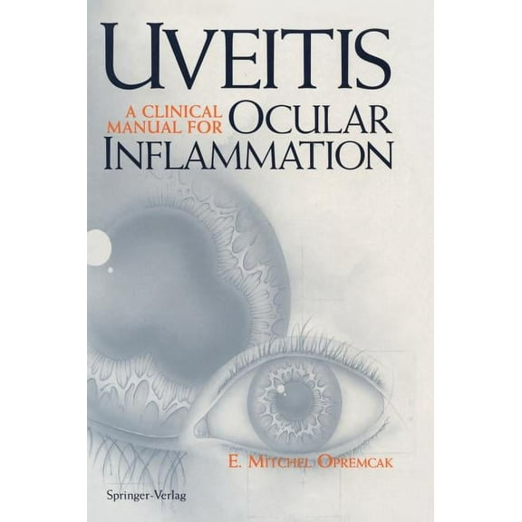 Uveitis: A Clinical Manual for Ocular Inflammation, (Hardcover)
