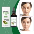 thumbnail image 2 of Cuidado nutritivo de la piel del cuero cabelludo Uñas Aceite de Neem Aceite de masaje Nutre profundamente la piel Uñas 100 ml Agua de esencia, 2 of 5