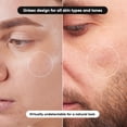 thumbnail image 5 of Hitworker 318pcs Hydrocolloid Pimple Patches - Salicylic Acid Acne Patches for Sensitive Skin, 5 of 5