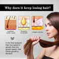 thumbnail image 2 of East Moon Hair Growth Liquid Moisturizing Hair Growth Thick Anti-Drop Hair Repair Scalp Massage Care, 2 of 5