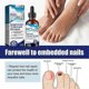 thumbnail image 2 of Ingrown Toenail Drops, Ingrown Toenail Treatment, Cuticle Care Oil For Ingrown Toenails, Extra Strength Nail Repair Solution, 2 of 5
