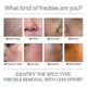 thumbnail image 4 of Jaysuing Niacinamide Essence Skin Fades Spots, Spots, Shrinks Pores, Hydrates, Anti-wrinkle, And Beautifies Skin. Anti-aging Skin Care K, 4 of 4
