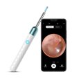 thumbnail image 1 of Smart Ear Picking Tool WiFi Ear Picking Artifact Visual Picking Ear Spoon，White, 1 of 2