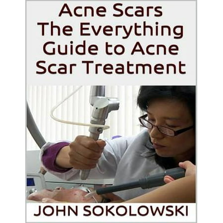 Acne Scars: The Everything Guide to Acne Scar Treatment -