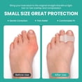 thumbnail image 4 of Welnove Pack of 12 Bunion Corrector, Toe Separators with 2 Loops, Big Toe Spacer Suitable for Bunion and Overlap Toe, Infused Aloe Vera Extract (Clear), 4 of 6