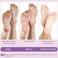thumbnail image 4 of Berlaney Foot Peeling Mask,  Peeling Mask for Dry, Cracked Heels & Calluses with Natural Lavender in 1-2 Weeks, Exfoliating Mask Make feet Baby Soft, 3 Pairs, Unisex, 4 of 8