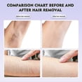 thumbnail image 5 of Women Face Epilator Facial Hair Removal For Women Smoothes Silky Wet/dry Face Body Epilator, 5 of 5