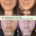 thumbnail image 3 of Set de ventosas faciales y herramienta facial Gua Sha Rena Chris Green, 3 of 7