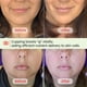 thumbnail image 3 of Set de ventosas faciales y herramienta facial Gua Sha Rena Chris Green, 3 of 7