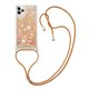 thumbnail image 1 of Funda FOXDOCK para iPhone 11 Pro con Cuerda Ajustable, Brillo Líquido, Protección Antigolpes y Lente – Ideal para Regalo, 1 of 6
