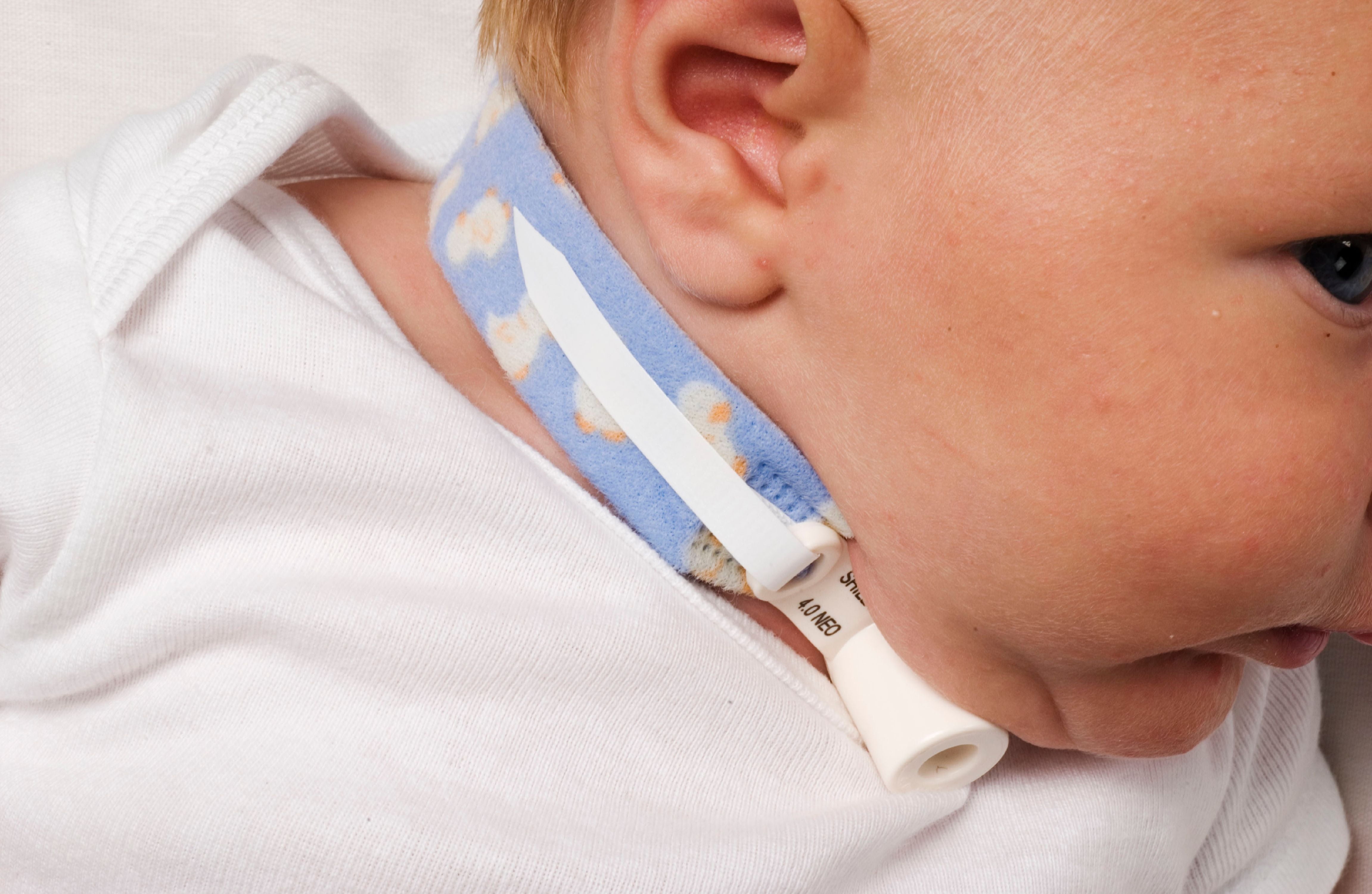 240 Blue Tracheostomy Tube Holder by Dale Medical BAK242H