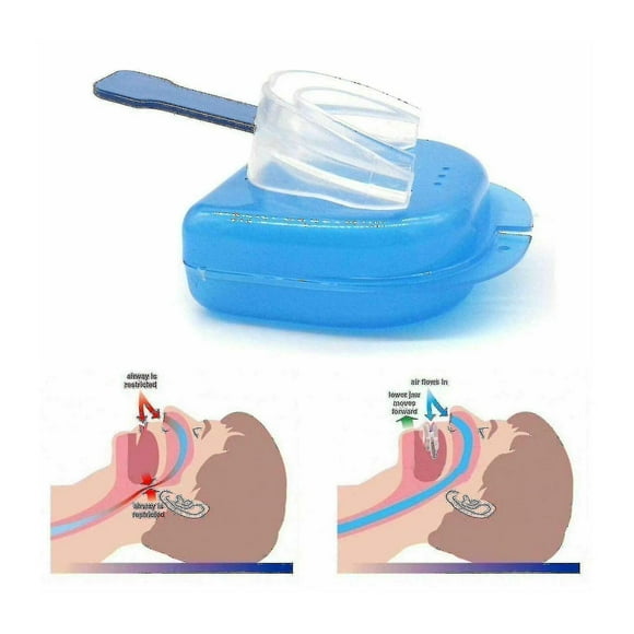 3 Mouthguards Snoring Assist Anti-snoring Sleep Mouthguard