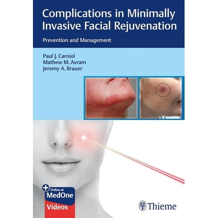 UPC: 9781684200139 | Complications in Minimally Invasive Facial Rejuvenation: Prevention and Management (Hardcover)