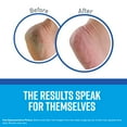 thumbnail image 2 of O'keeffe's Healthy Feet Foot Cream (Pack of 14), 2 of 6