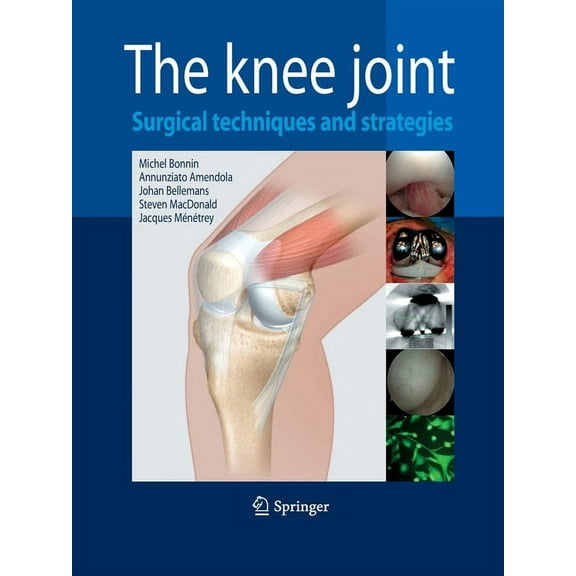 The Knee Joint: Surgical Techniques and Strategies, (Paperback)