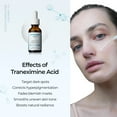 thumbnail image 4 of Dr.Melaxin_TX_Line_30ml_Ampoule_Whitening_Moisturizer,3PC, 4 of 10