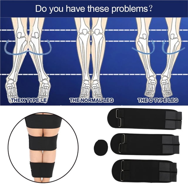 Corrector De Postura Profesional X/O Forma Pierna Corrección Cinturón Bowleg Correct Band Xl Vogacara AF000330-00