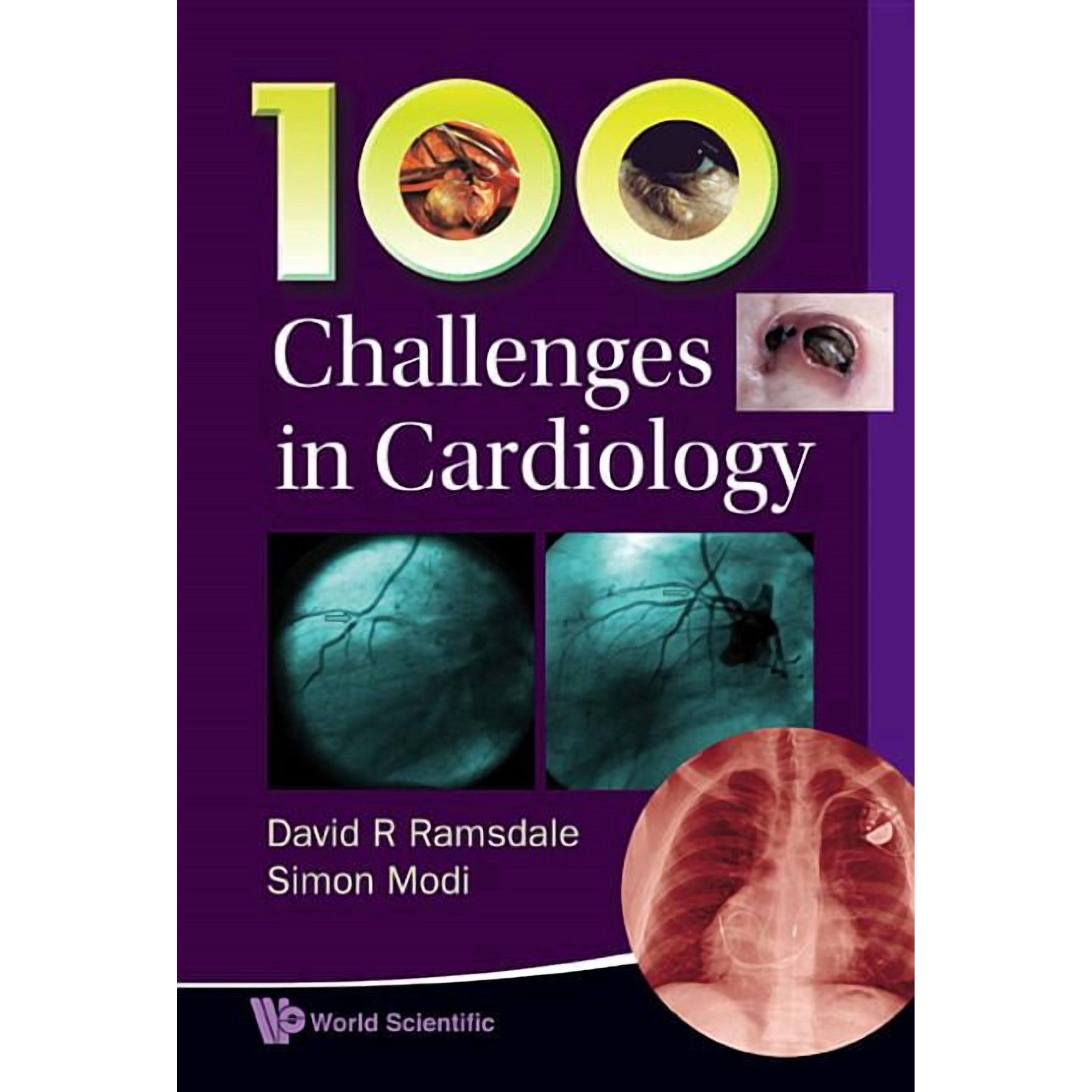 100 Challenges in Cardiology, (Paperback)
