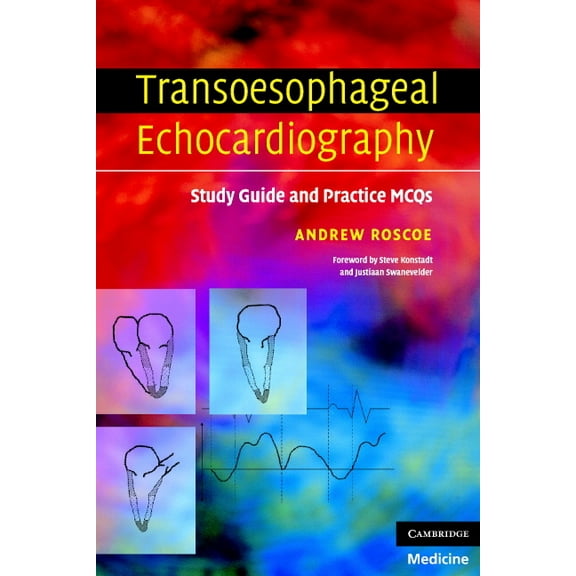 Transoesophageal Echocardiography: Study Guide and Practice Questions (Paperback) by Andrew Roscoe