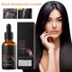 thumbnail image 3 of Sérum orgánico para el crecimiento del cabello para mujeres y hombres con aceite de sésamo negro y romero, 3 unidades. Tratamiento para la caída del cabello., 3 of 5