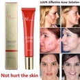 thumbnail image 4 of Outils de Beauté Doux - Extrait Anti-Rides Marques Visage 20g, 4 of 9