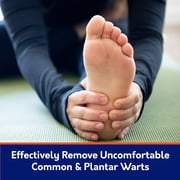 Compound W Freeze off Wart Remover, 8 Swab Freeze Applications and 12 CushionDiscs