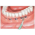 thumbnail image 2 of GUM Soft-Picks Advanced, Easy to Use Dental Picks for Teeth Cleaning and Gum Health, Disposable Interdental Brushes with, 2 of 8