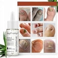 thumbnail image 4 of Onychomycosis Strong Nail Repair Liquid, 4 of 5