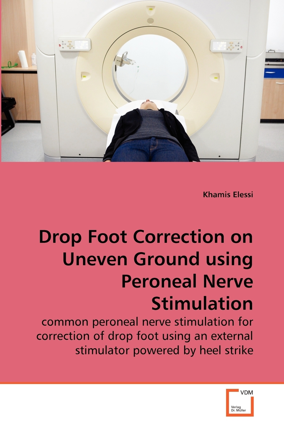 Drop Foot Correction on Uneven Ground Using Peroneal Nerve Stimulation
