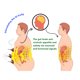 thumbnail image 2 of 10 Uds desintoxicación adelgazante quema columna moldeadora de cuerpo Moxa Stick cuidado de la salud Ygjytge Cuidado Belleza, 2 of 5