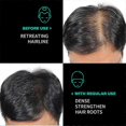 thumbnail image 4 of 1-3x Unrefined Batana Oil for Hair Growth, Organic Pure Batana Oil, Hair Growth Oil Also Helps with Frizz, Split Ends, Texture & Shine, 4 of 5