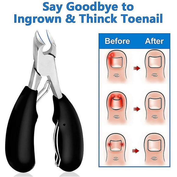 Toe Nail Clippers For Thick Or Ingrown Nails Heavy Duty Stainless