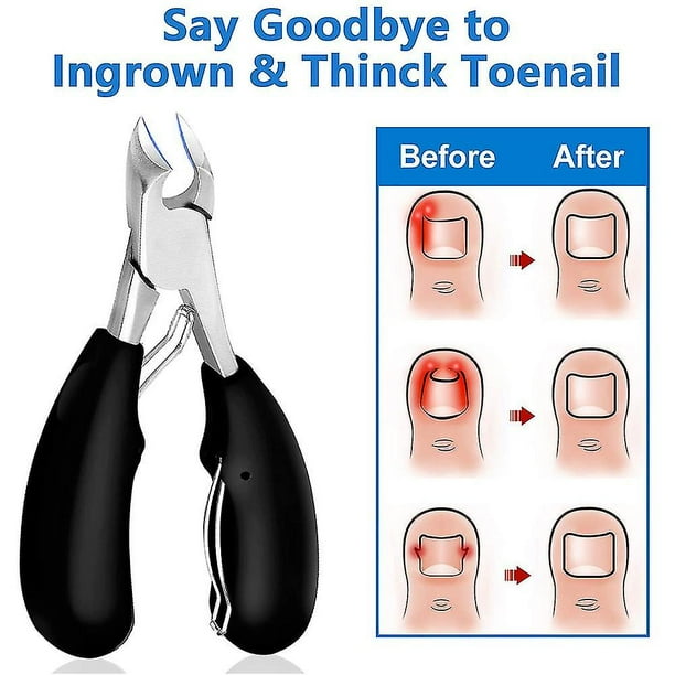 Podiatrist Toenail Clippers, Professional Thick & Ingrown Toe Nail